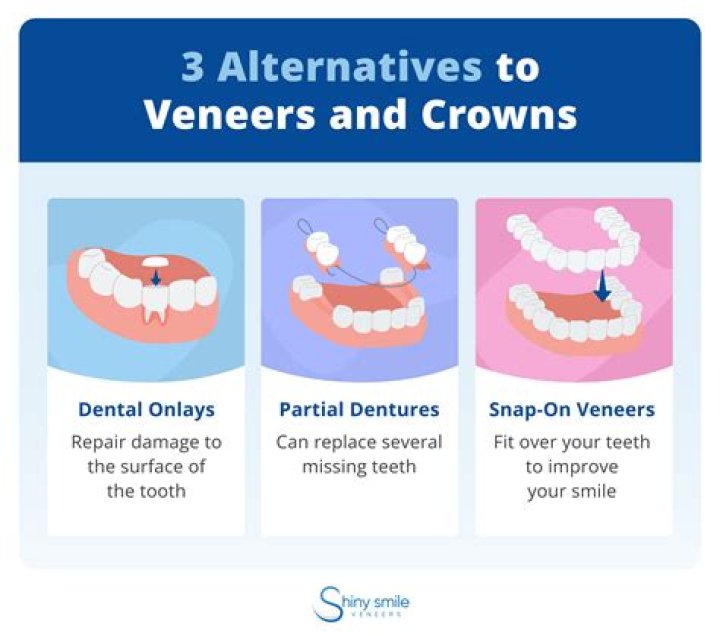 Are crowns better than teeth?