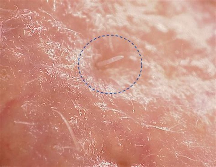 Are mites visible?
