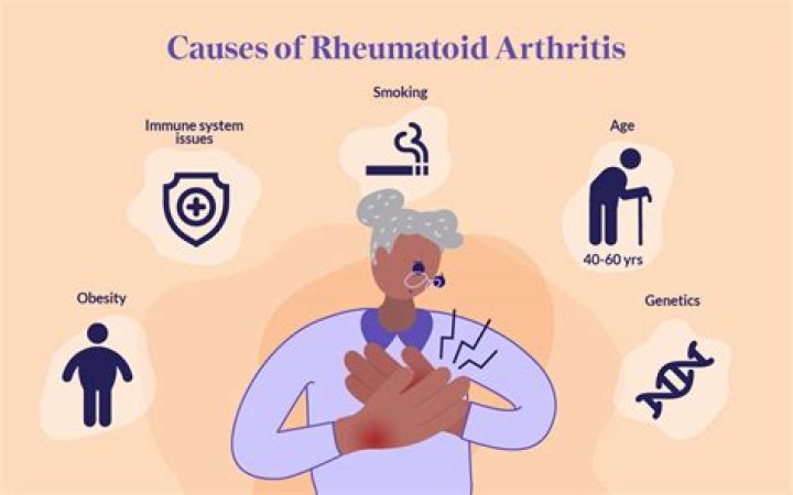 Are people with rheumatoid arthritis more at risk for COVID-19?