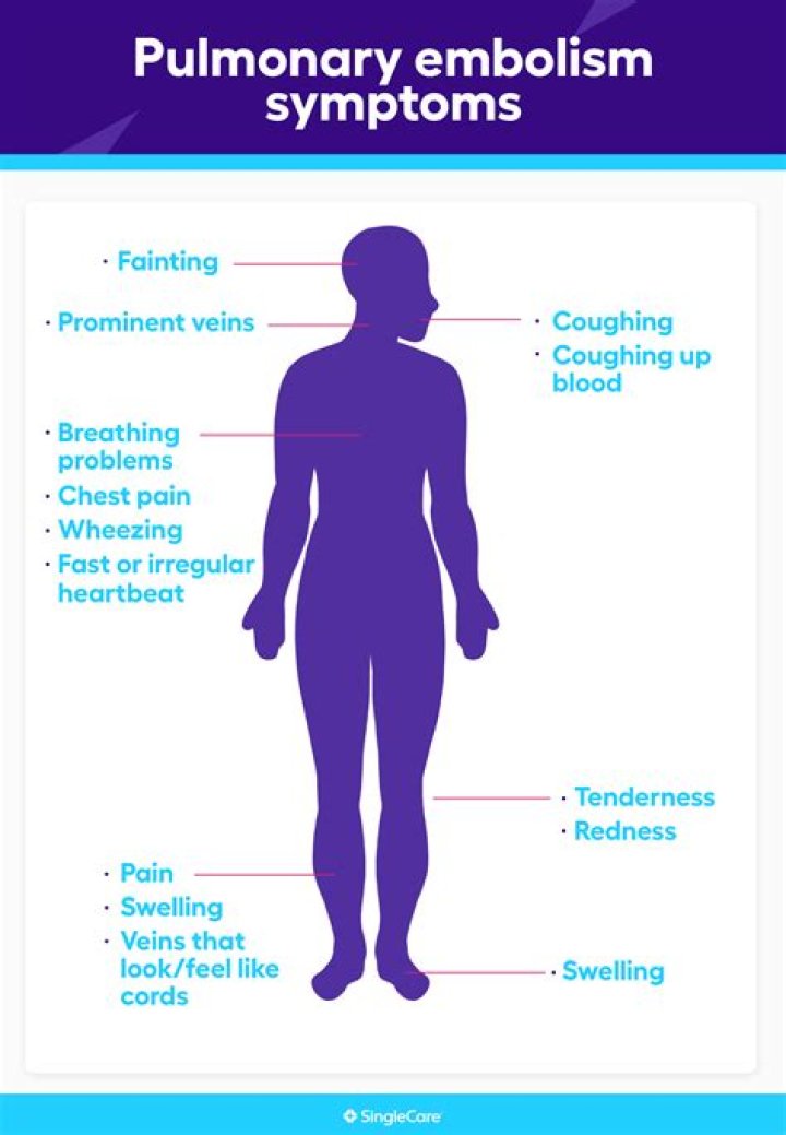 Are there warning signs before a pulmonary embolism?