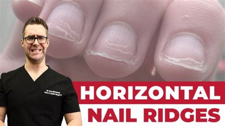 At what age do nails get ridges?