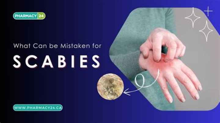 Can a baby be mistaken for a cyst?
