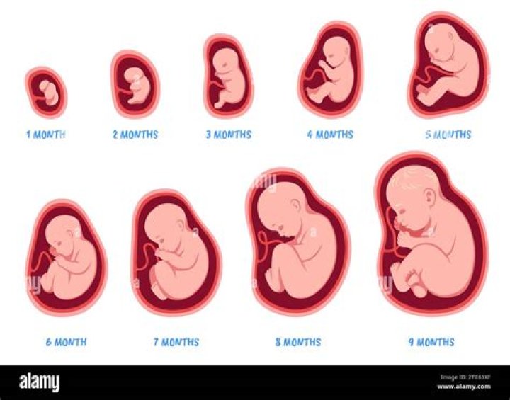 Can a fetus dream?