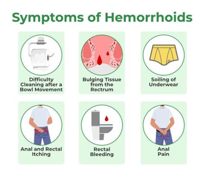 Can a hemorrhoid pop?