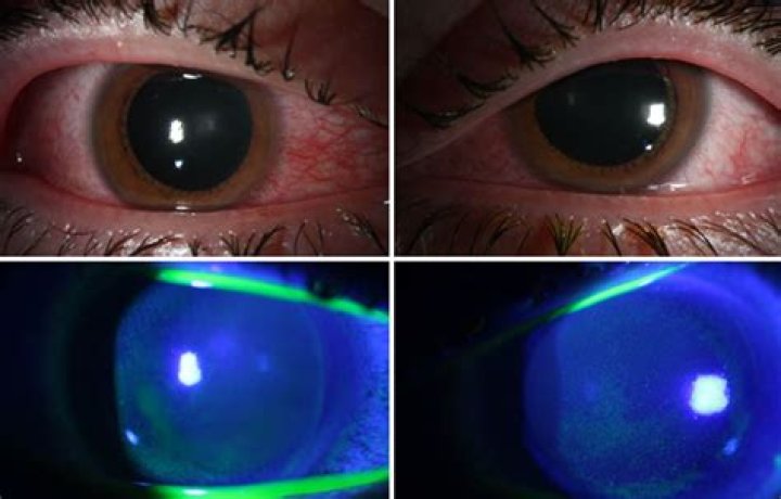 Can Blacklight damage eyes?
