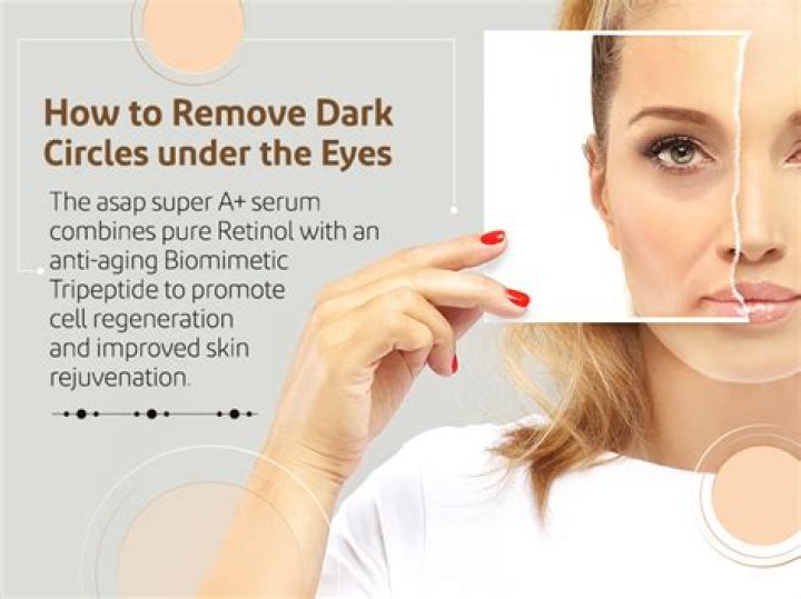 Can coconut oil remove dark circles?