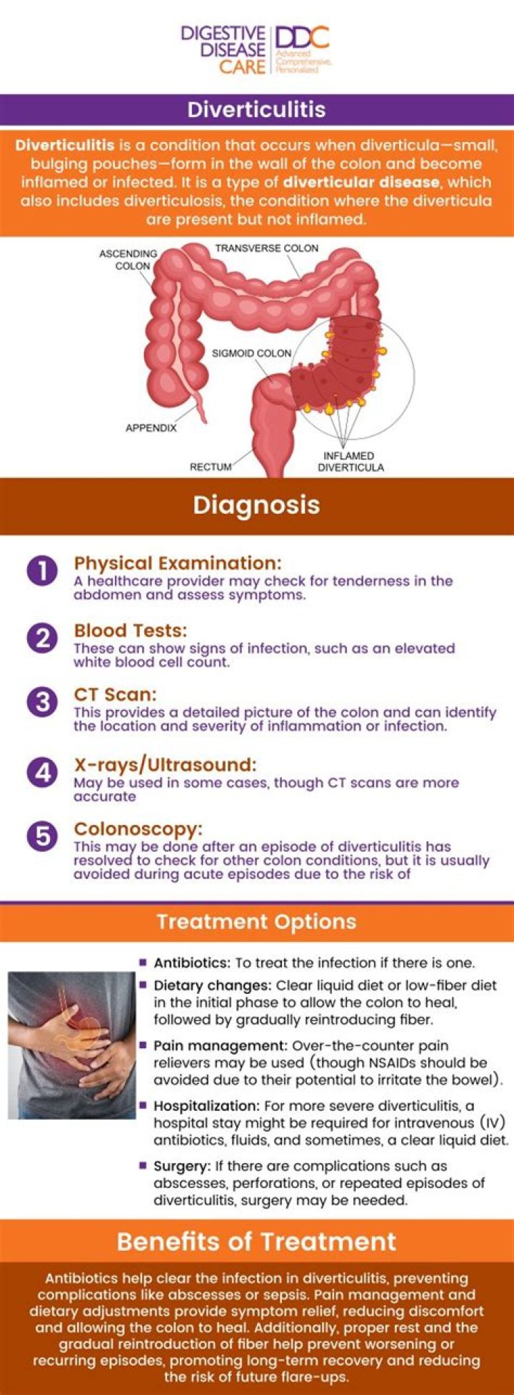 Can diverticulitis cause leg pain?