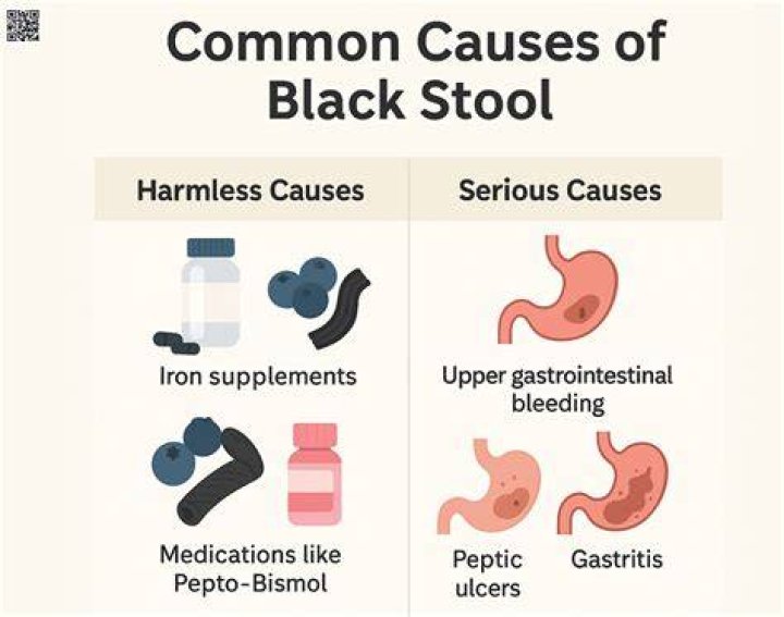 Can folic acid cause black stool?