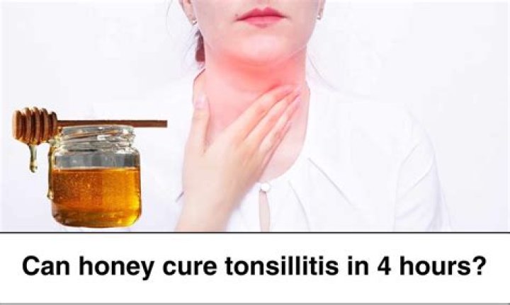 Can honey cure rashes?