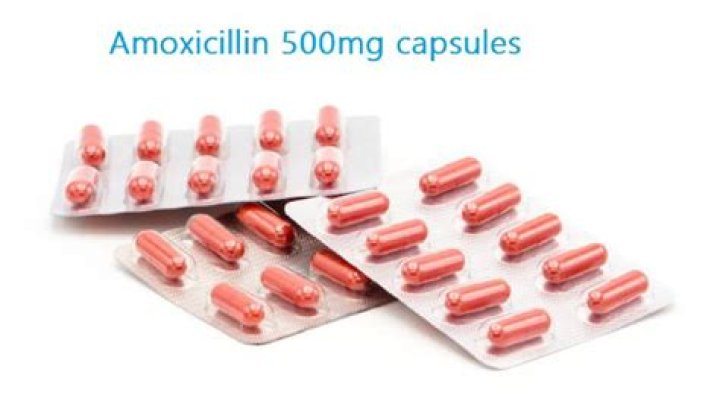Can I buy amoxicillin over the counter?