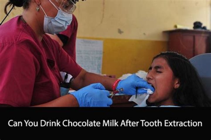 Can I drink cold milk after tooth extraction?