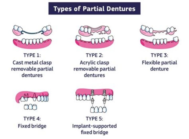 Can I see what I would look like with dentures?