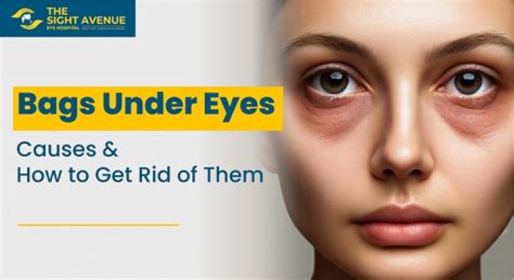 Can low iron cause bags under eyes?