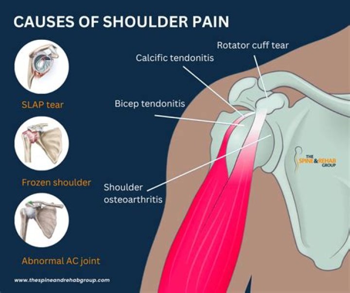 Can melanoma cause shoulder pain?