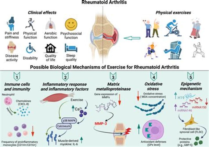 Can no exercise cause arthritis?