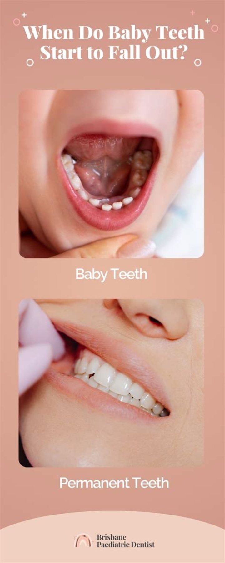 Can tartar make your teeth fall out?