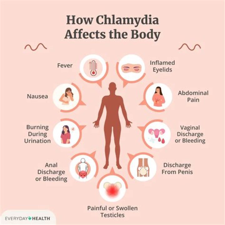 Can UTI be mistaken for chlamydia?