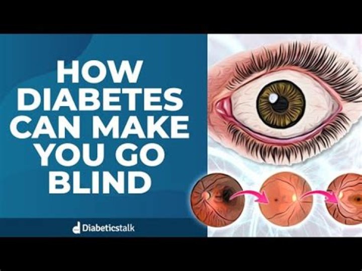 Can Vaseline make you go blind?