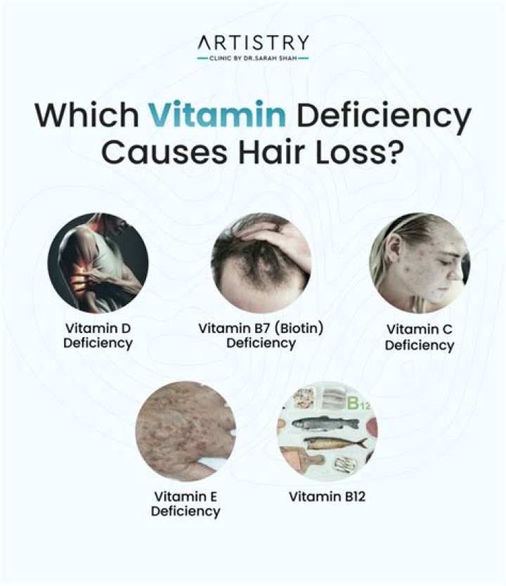 Can vitamin D deficiency cause hair thinning?