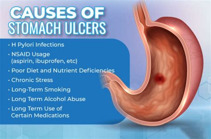 Can you get stomach ulcers from not eating?
