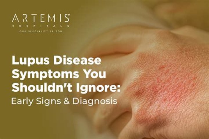 Can you have lupus for years and not know it?