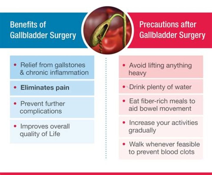 Can you have your gallbladder removed without being put to sleep?