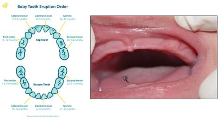 Can you put a baby tooth back in?