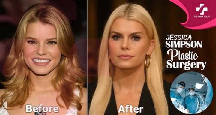 Did Jessica Simpson have ac section?