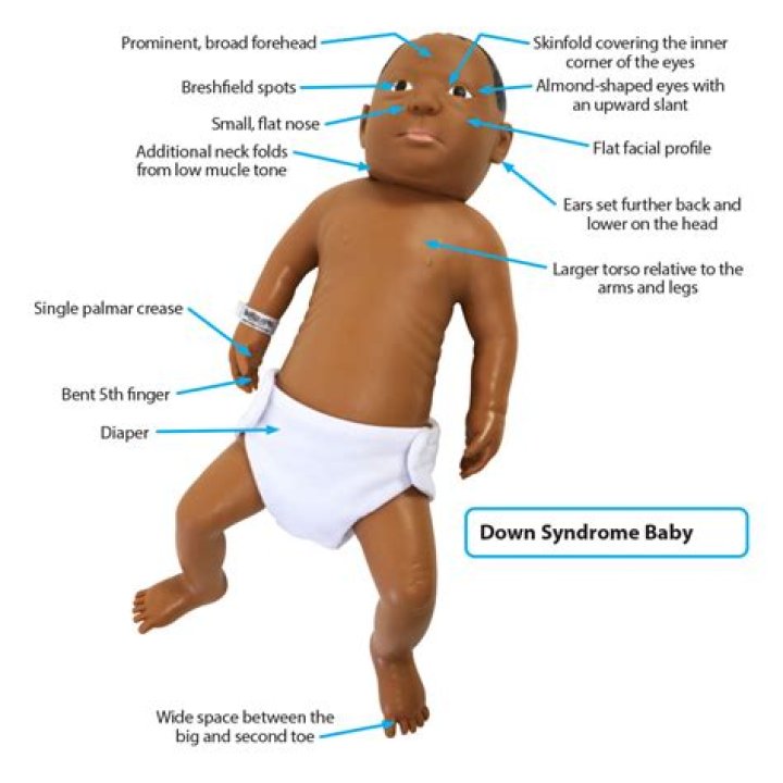Do babies with Down syndrome have a lower birth weight?