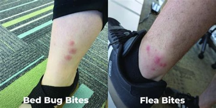 Do bed bugs bite on your feet?