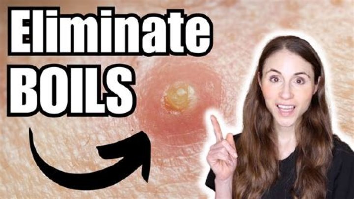 Do boils stink?