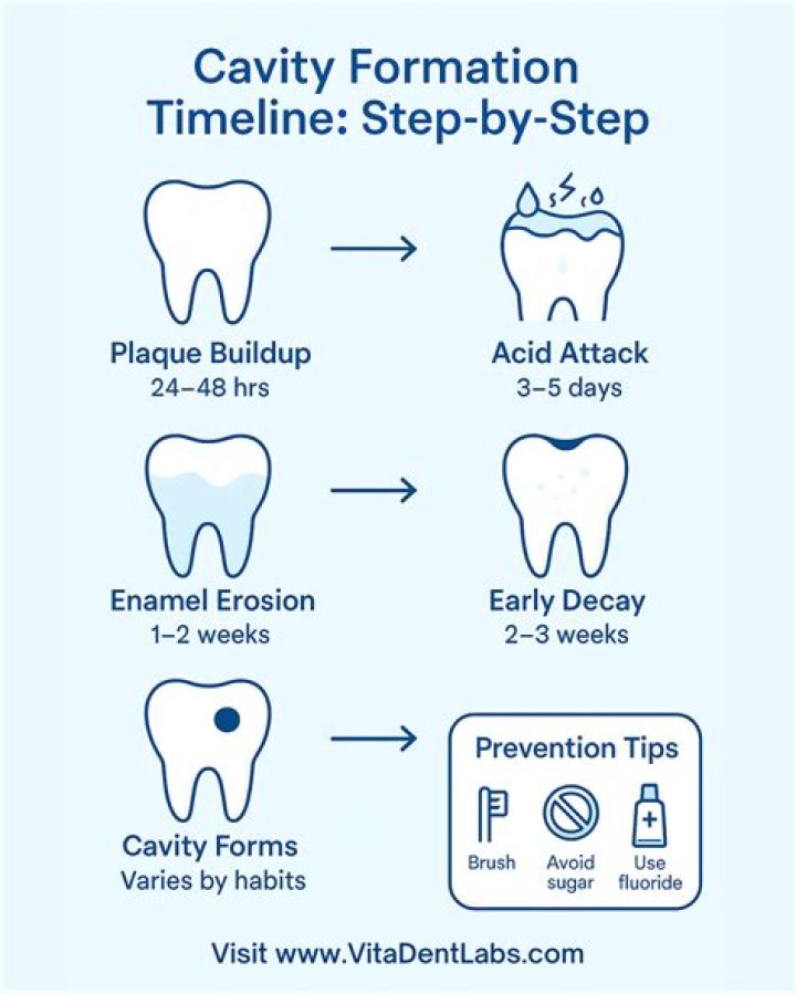 Do cavities develop overnight?