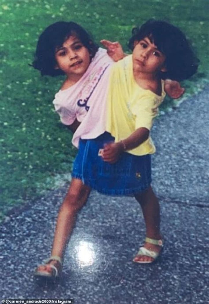 Do conjoined twins share thoughts?