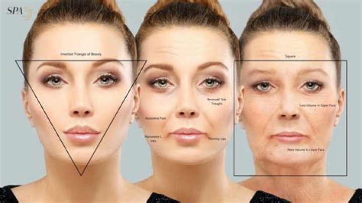 Do dentures make your face fuller?