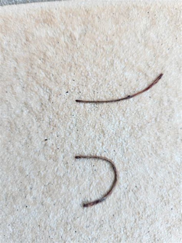 Do drain worms bite?