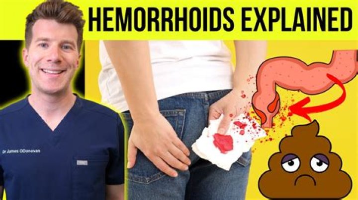 Do hemorrhoids make your bum ache?