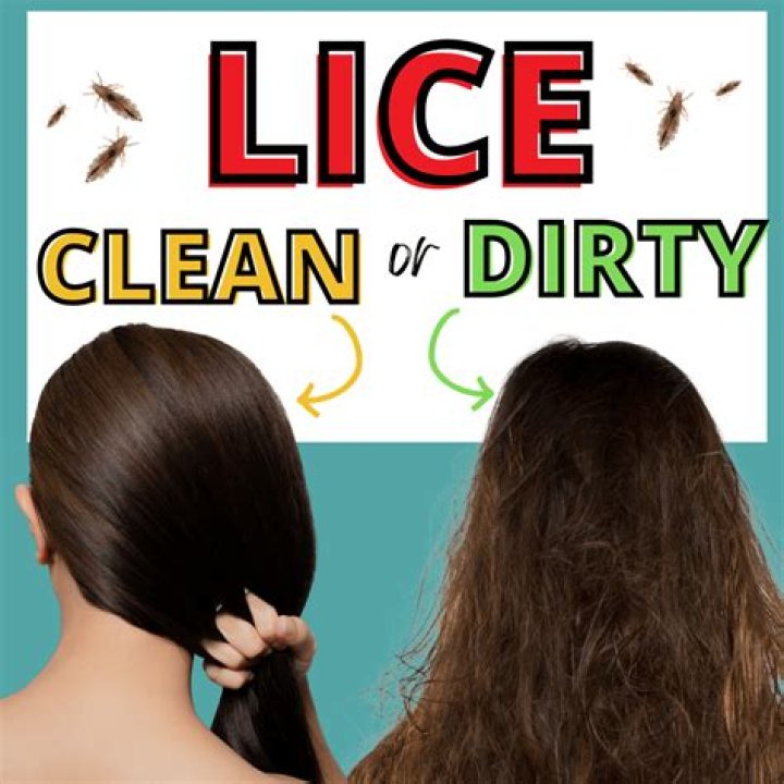 Do lice like wet or dry hair?