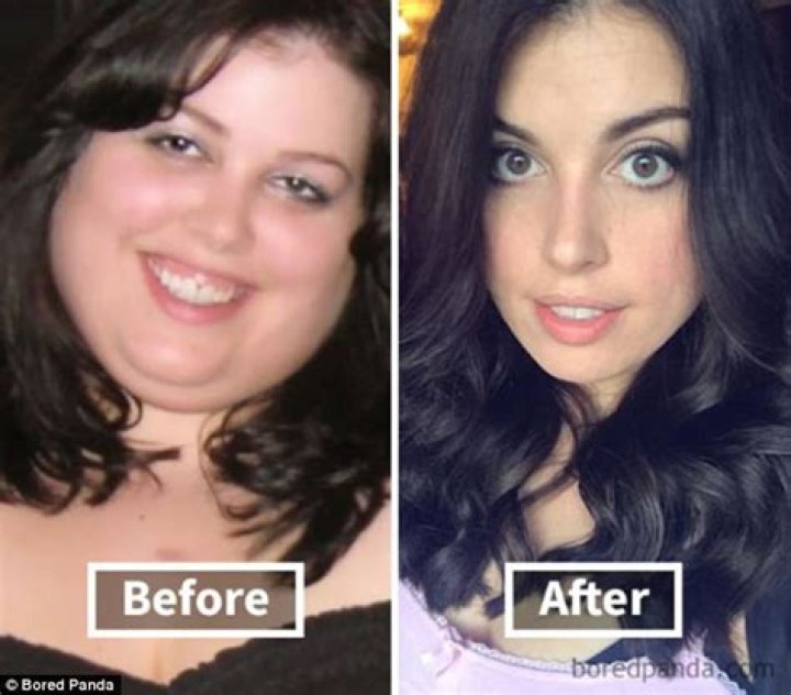 Do lips get smaller with weight loss?