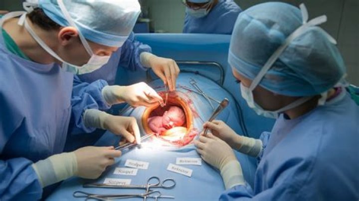 Do they take organs out during embalming?