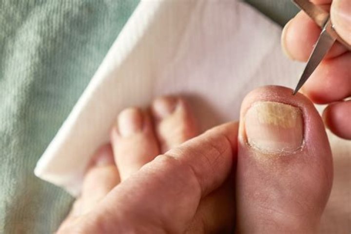 Do toenails get more brittle with age?