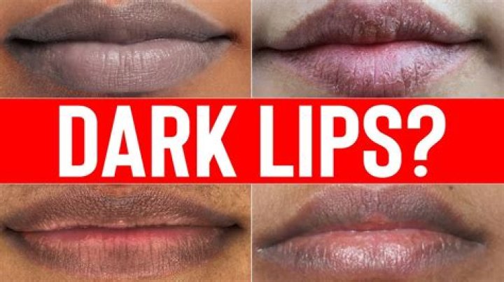 Do Vapes make your lips black?