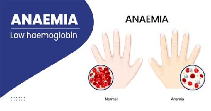 Does anemia cause white hair?