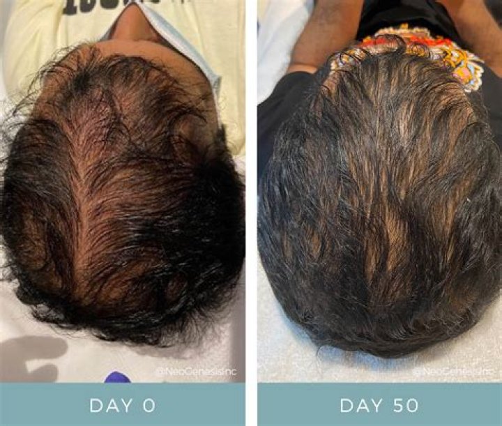 Does castor oil regrow hair?