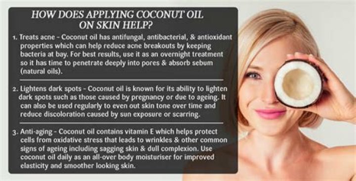 Does coconut oil help hypopigmentation?