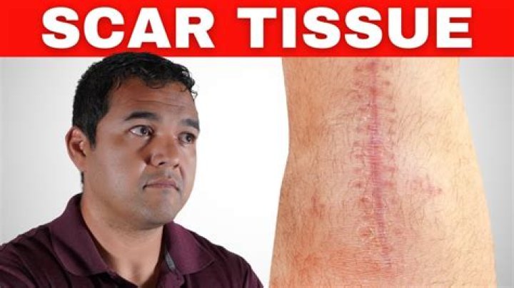 Does curettage leave a scar?