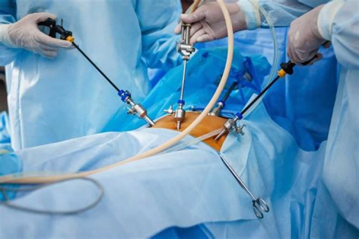 Does endometriosis go away after laparoscopy?