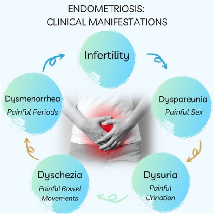 Does endometriosis pain happen everyday?