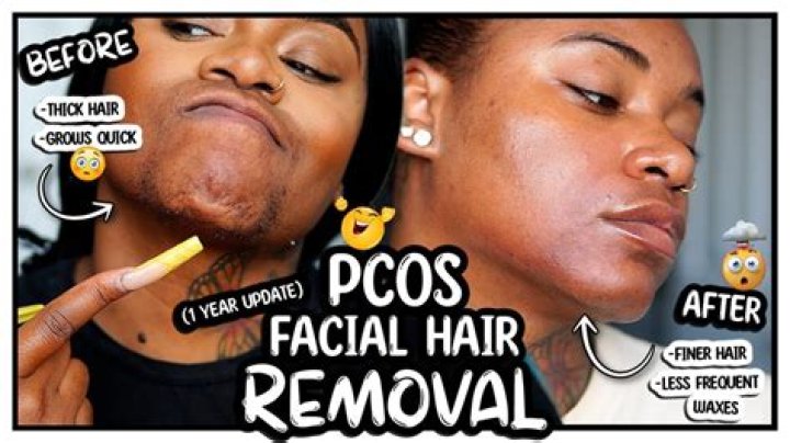 Does every girl have facial hair?