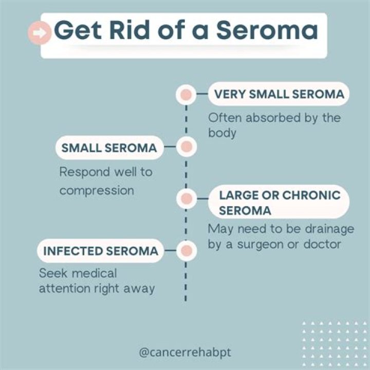 Does exercise help seroma?
