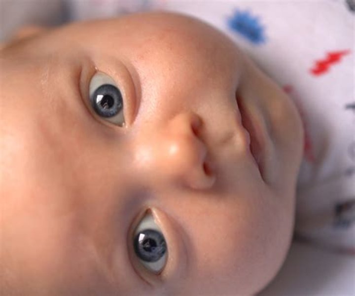 Does hair in toddlers eyes affect vision?